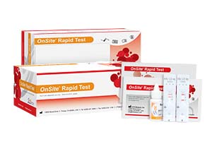 Teste rápido de anticorpos HIV